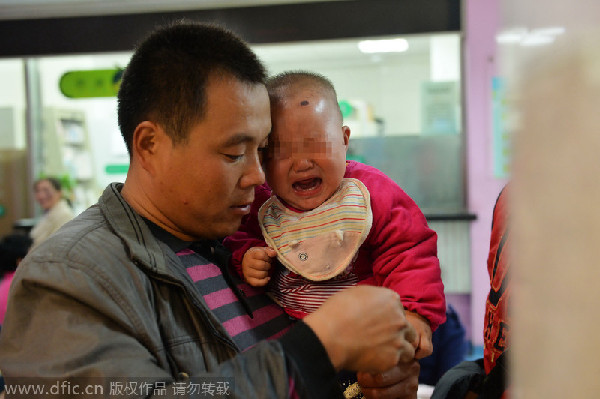 Needles removed from baby's body