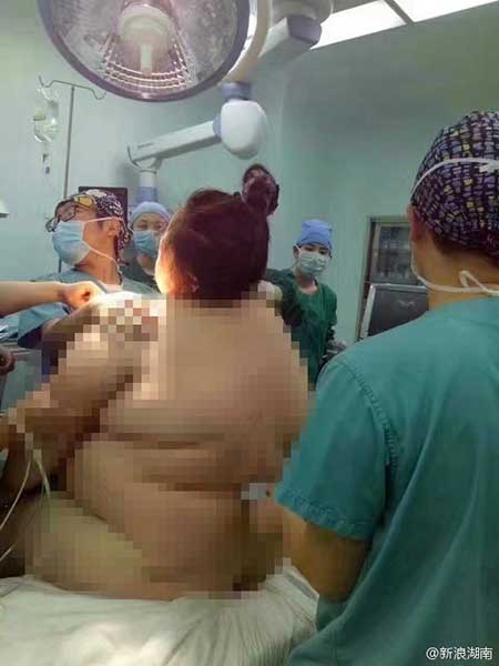 16 medical staff members help 140kg woman deliver baby