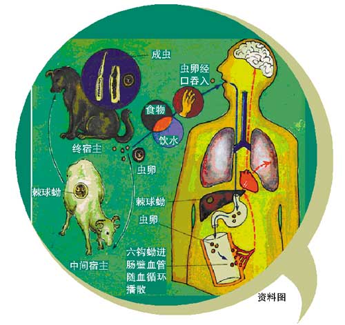 少女長期與寵物睡覺 遭“寵物蟲”噬骨導(dǎo)致癱瘓