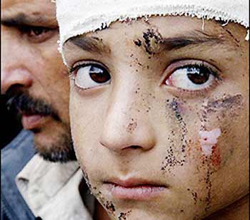 A Kashmiri injured looks on while waiting outside a makeshift medical center in the earthquake-devastated Muzaffarabad, capital city of Pakistan administered Kashmir.