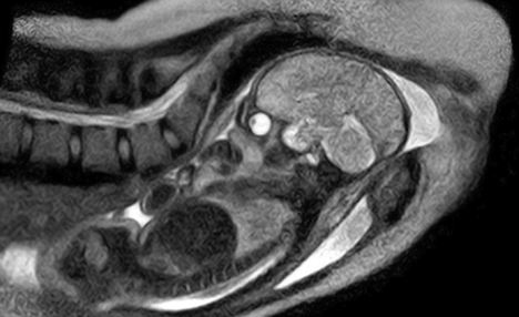 德國利用核磁共振成像拍出全球首套嬰兒降生圖片
