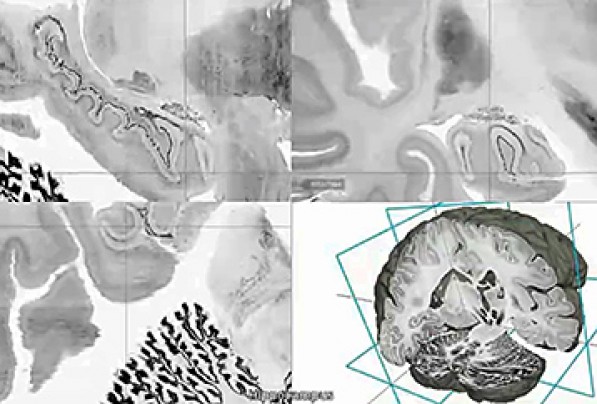 科學家繪制出3D人腦高清模型