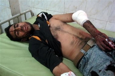 An injured Iraqi man lies at a hospital after a suicide car bomber crashed into an Iraqi police checkpoint, killing 33 and injuring 75 at an entrance to Sadr City, the capital's biggest Shiite Muslim neighborhood, in Baghdad, Iraq, Wednesday, April 18, 2007. Four large bombs exploded in mostly Shiite areas of Baghdad on Wednesday, killing at least 164 people and wounding scores  the deadliest day in the city since the start of the U.S.-Iraqi campaign to pacify the capital. (AP 